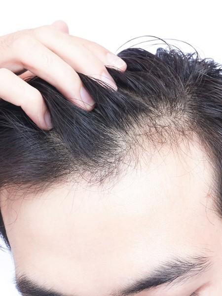 micropigmentation micropigmentation