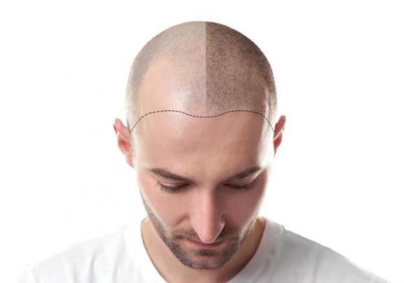 pigmentation cheveux pigmentation cheveux